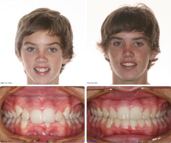 BeforeAfter_Patient9