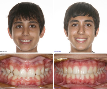 BeforeAfter_Patient4